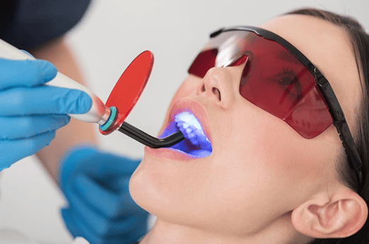 Teeth Cleaning